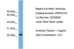WB Suggested Anti-HAX1  Antibody Titration: 0. (HAX1 antibody  (Middle Region))