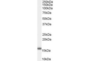 Western Blotting (WB) image for anti-Arachidonate 5-Lipoxygenase (ALOX5) (C-Term) antibody (ABIN2789351) (ALOX5 antibody  (C-Term))