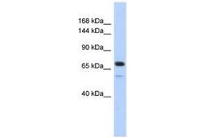 Image no. 1 for anti-Caldesmon 1 (CALD1) (AA 467-516) antibody (ABIN6743120) (Caldesmon antibody  (AA 467-516))