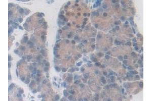 Immunohistochemistry (IHC) image for anti-Pyridoxal Kinase (PDXK) (AA 35-251) antibody (ABIN7440311)