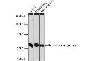 Western blot analysis of extracts of various cell lines, using Thromboxane synthase Rabbit mAb (ABIN7270821) at 1:1000 dilution. (TBXAS1 antibody)