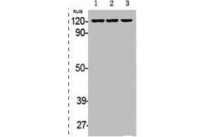 EPH Receptor B1 抗体  (pTyr594, pTyr604)