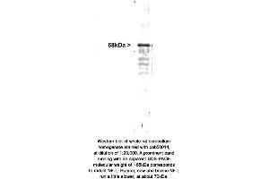 Image no. 1 for anti-Neurofilament (Light Chain) antibody (ABIN363323) (Neurofilament (Light Chain) antibody)