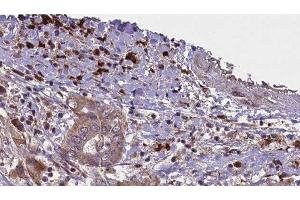 Immunohistochemistry (IHC) image for anti-Alkaline Phosphatase, Liver/bone/kidney (ALPL) (Internal Region) antibody (ABIN6259900)
