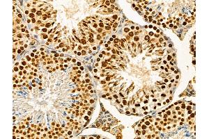anti-Hephaestin (HEPH) (Internal Region) antibody