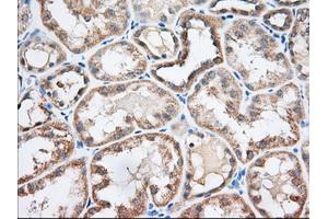 Immunohistochemical staining of paraffin-embedded Human liver tissue using anti-EIF2S1 mouse monoclonal antibody. (EIF2S1 antibody)
