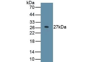 Detection of Recombinant WIF1, Human using Polyclonal Antibody to WNT Inhibitory Factor 1 (WIF1) (WIF1 antibody  (AA 29-379))