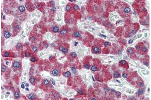 Human Liver: Formalin-Fixed, Paraffin-Embedded (FFPE) (PAR1 antibody  (AA 24-37))