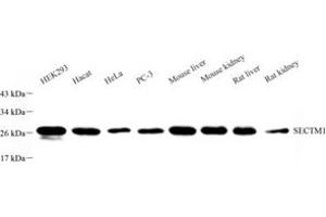 Western blot analysis of SECTM1 (ABIN7075524) at dilution of 1: 1000 (SECTM1 antibody)