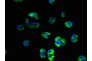 Immunofluorescent analysis of MCF-7 cells using ABIN7174993 at dilution of 1:100 and Alexa Fluor 488-congugated AffiniPure Goat Anti-Rabbit IgG(H+L) (USMG5 antibody  (AA 2-58))