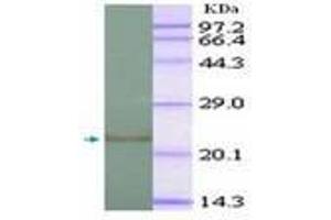 Image no. 2 for anti-Interleukin 1, beta (IL1B) (AA 118-269) antibody (ABIN791567) (IL-1 beta antibody  (AA 118-269))