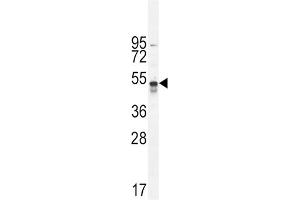 Western Blotting (WB) image for anti-TNFR-S274 antibody (ABIN2996049) (TNFR-S274 antibody)