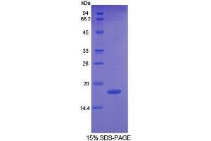 SDS-PAGE (SDS) image for Angiopoietin 2 (ANGPT2) (AA 24-165) protein (His tag) (ABIN1169863)