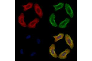 ABIN6256196 and ABIN6267433 staining Hela cells(4h of LPS treatment) by IF/ICC.
