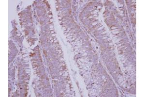 IHC-P Image Immunohistochemical analysis of paraffin-embedded human colon carcinoma, using BMP10, antibody at 1:250 dilution.