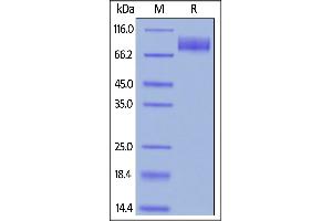 Biotinylated Human CA125, Fc,Avitag on  under reducing (R) condition. (MUC16 Protein (AA 12660-12923) (Fc Tag,AVI tag,Biotin))