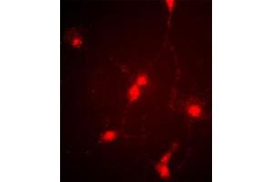 Immunofluorescence image of cultured chick retinal amacrine (neuronal) cells labeled with CLC4 Antibody (C-term).