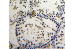 Used in DAB staining on fromalin fixed paraffin-embedded Testis tissue (ZNF384 antibody  (AA 307-540))