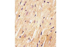 (ABIN6242465 and ABIN6577972) staining (Mouse) Med15 in Mouse heart tissue sections by Immunohistochemistry (IHC-P - paraformaldehyde-fixed, paraffin-embedded sections). (MED15 antibody  (C-Term))