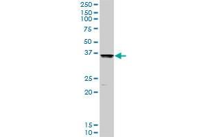 COMT MaxPab rabbit polyclonal antibody. (COMT antibody  (AA 1-221))