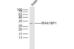 Mouse brain lysates probed with IRAK1BP1 Polyclonal Antibody, Unconjugated  at 1:300 dilution and 4˚C overnight incubation.