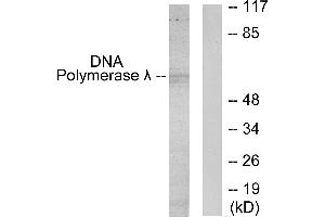 Western blot analysis of extracts from 293 cells, using DNA Polymerase λ antibody.