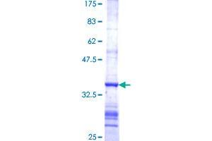 Ferredoxin Reductase Protein (FDXR) (AA 394-491) (GST tag)