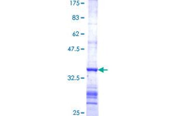 Ferredoxin Reductase Protein (FDXR) (AA 394-491) (GST tag)