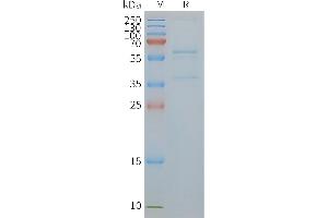 GLUT4 Protein