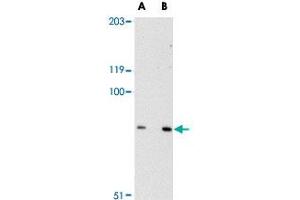 Western blot analysis of SPG11 in mouse heart tissue lysate with SPG11 polyclonal antibody  at (A) 0.