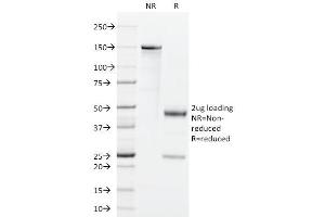 SDS-PAGE Analysis Purified GM-CSF Rat Monoclonal Antibody (BVD2-21C11). (GM-CSF antibody)