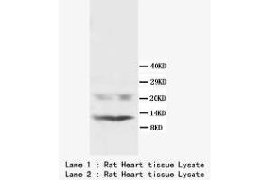 Image no. 1 for anti-Phospholamban (PLN) (N-Term) antibody (ABIN1495356) (Phospholamban antibody  (N-Term))