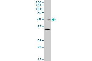 GATA3 monoclonal antibody (M01), clone 1C1 Western Blot analysis of GATA3 expression in A-431 . (GATA3 antibody  (AA 103-200))