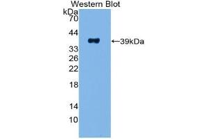 Western blot analysis of the recombinant protein. (PPY antibody  (AA 30-87))