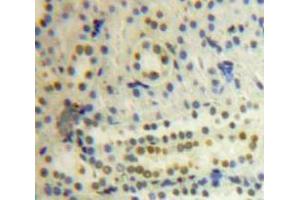 Used in DAB staining on fromalin fixed paraffin-embedded Kidney tissue (PSMC3 antibody  (AA 2-439))
