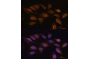 Immunofluorescence analysis of U-2 OS cells using RPS6K antibody (ABIN7270037) at dilution of 1:100.