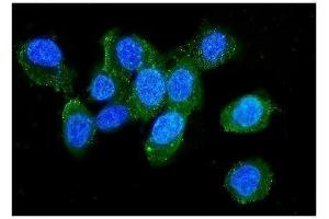 IF analysis of LCP1 using anti-LCP1 antibody (ABIN6719421). (LCP1 antibody)