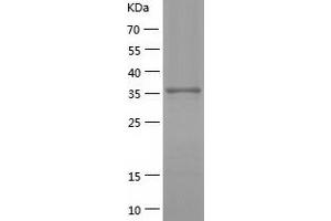 Western Blotting (WB) image for Zinc Finger Protein interacting with Ribonucleoprotein K (ZIK1) (AA 1-384) protein (His tag) (ABIN7125804) (ZIK1 Protein (AA 1-384) (His tag))