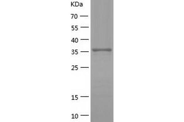 ZIK1 Protein (AA 1-384) (His tag)