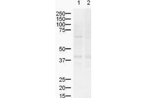 Western blot using  Affinity Purified anti-ZIC2 antibody shows detection of a band ~55 kDa (arrowhead) corresponding to ZIC2 in lysates from (lane 1) mouse brain and (lane 2) rat brain. (ZIC2 antibody  (AA 189-206))