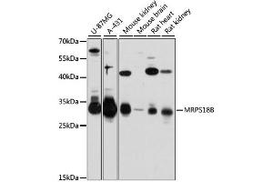 Western blot analysis of extracts of various cell lines, using MRPS18B antibody (ABIN6293873) at 1:3000 dilution. (MRPS18B antibody)