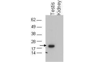 Image no. 1 for anti-Glutathione Peroxidase 4 (GPX4) (C-Term) antibody (ABIN199918) (GPX4 antibody  (C-Term))