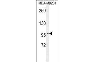 ST7 Antikörper  (AA 169-197)