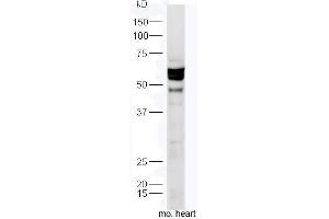 Mouse heart lysates probed with Anti-TXA2R Polyclonal Antibody, Unconjugated  at 1:300 in 4˚C. (TBXA2R antibody  (AA 51-150))