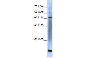 WB Suggested Anti-SMARCE1 Antibody Titration: 0. (SMARCE1 antibody  (N-Term))