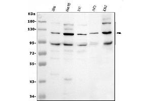 Western blot analysis of PML using anti-PML antibody (ABIN4886699). (PML antibody  (N-Term))