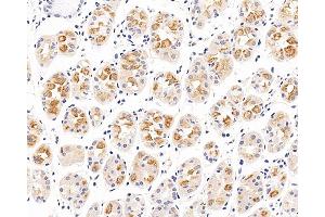 Immunohistochemistry analysis of paraffin-embedded human stomach using CXCR7 Polyclonal Antibody at dilution of 1:100. (CXCR7 antibody)