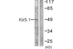 Western Blotting (WB) image for anti-Potassium Inwardly-Rectifying Channel, Subfamily J, Member 16 (KCNJ16) (Ser416) antibody (ABIN1848056) (KIR5.1 antibody  (Ser416))