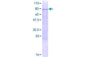 Image no. 1 for Cytokeratin 79 (AA 1-535) protein (GST tag) (ABIN1309034) (Cytokeratin 79 Protein (AA 1-535) (GST tag))