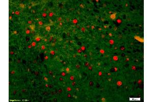 Formalin-fixed and paraffin-embedded rat brain labeled with Anti-HSTF2/HSF2 Polyclonal Antibody, Unconjugated (ABIN686137) 1:200, overnight at 4°C, The secondary antibody was Goat Anti-Rabbit IgG, Cy3 conjugated used at 1:200 dilution for 40 minutes at 37°C. (HSF2 antibody  (AA 401-536))
